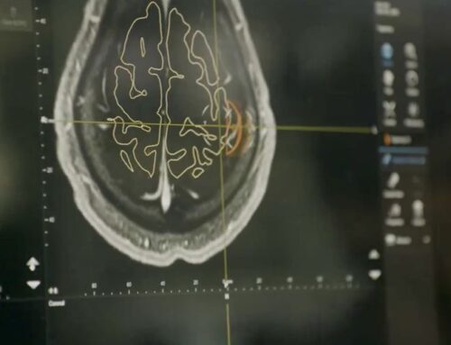 China Goes Crazy About Implanting Brain Chips, Just Waiting for the Explosion